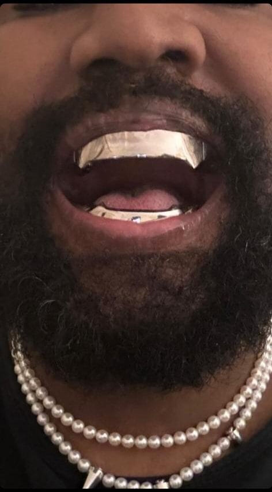 Kanye West onthult opvallende titanium tandprothese met een prijs van maar liefst $ 850.000