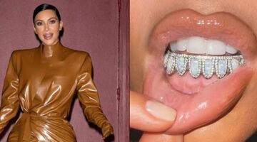 Kim Kardashian tanden