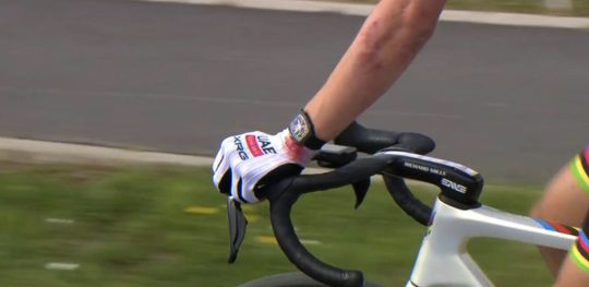 Tadej Pogačar rijdt met een door een Richard Mille-horloge veroorzaakte verwonding tijdens de wielerklassieker Parijs-Roubaix