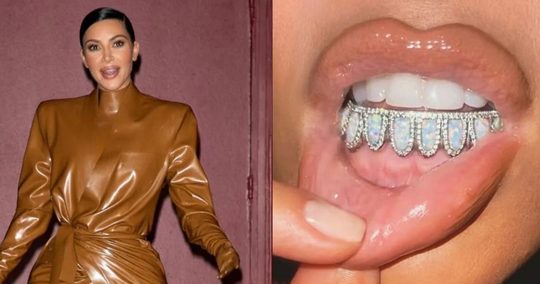 Kim Kardashian tanden