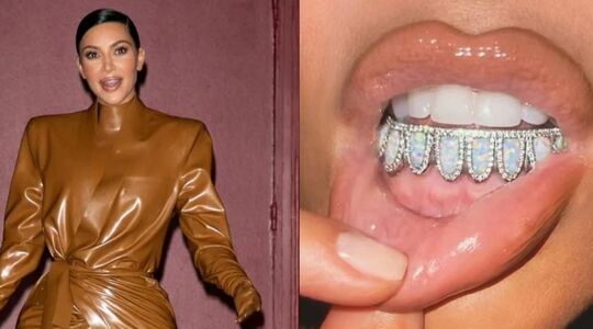 Kim Kardashian tanden