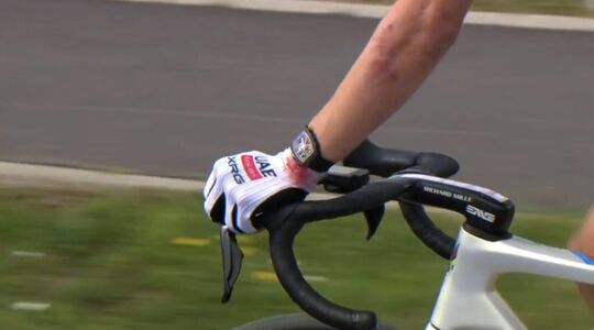 Tadej Pogačar rijdt met een door een Richard Mille-horloge veroorzaakte verwonding tijdens de wielerklassieker Parijs-Roubaix